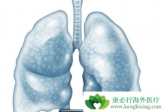 �ΰ�������ǰ֢״�����ڻ�����ʹ�ͺ���������