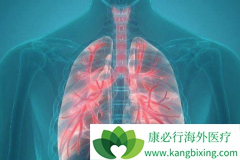 �ΰ����ڴ�Ⱦ�𣿷ΰ���ν�������