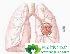 �ΰ����ڴ�Ⱦ��������Щ���ؾ�����