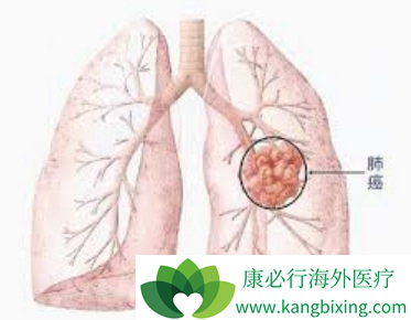 �ΰ����ڴ�Ⱦ��