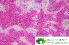 �������ὺ�����������ڷ�������ʹ�����޽�չ�������ӳ�1��