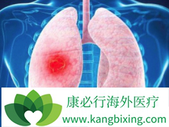 �ΰ�������ô�����Ƿΰ����������ĵ�����