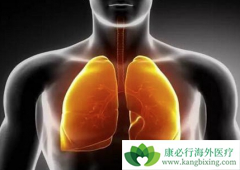 �ΰ����ڻ��Ƶ�ע����������Щ