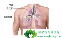 �ΰ����ڻᴫȾ��?�ΰ������ܻ�೤ʱ��