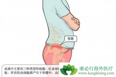 ��Щ��Ⱥ�������ܵ���Ѫ������Ϯ