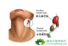 �򵥽����ܰ��������Ʒ���������Ч��