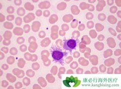 ����Bϵ�ܰ�ϸ����Ѫ���Ĳ���ԭ��֢״