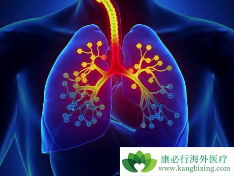 肺癌晚期有治好的吗 肺癌晚期有治好的吗