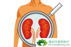 ��������(Cometriq)�����������������ӳ��������ߵ�PFS