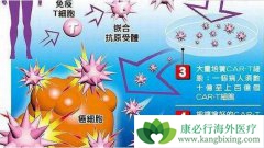 Car-T����ʵ���������̱�ʽͻ�� NBT