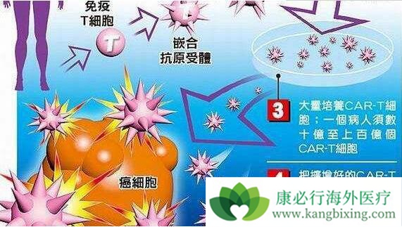 CAR-T