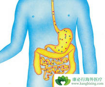 ������(STIVARGA)���������е�θ����������������