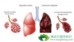 �ΰ���ת�Ƶ�֢״����Щ����ʲô�������Խ�����ϣ�