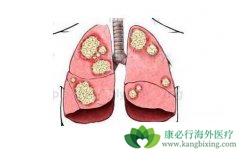 ���Ʒ�Сϸ���ΰ�������EGFR-TKI����ҩ���ص㼰Ӧ��