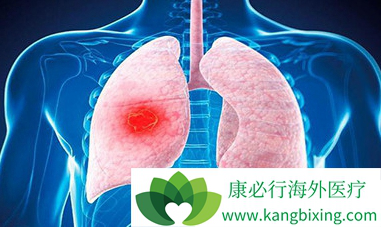 印度特罗凯 印度特罗凯