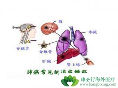 �ΰ���ת��֮�����������к�����