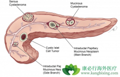 ���ٰ������ڼ仼��Ӧ��δ�����ʹ�͹���