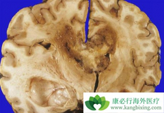 �߼�������˹͡/���������н��ͽ���ĸϸ��������OS������