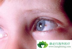 ����ҽ�ƽ�����α���۾��׺�ɫ������֢״��