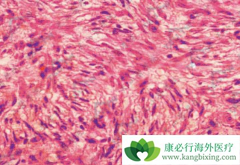 ¡ͻ��Ƥ����ά������һ��ԭ����������������Ƥ������