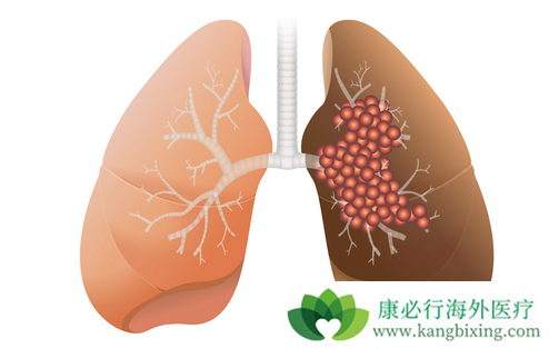 �ΰ�����