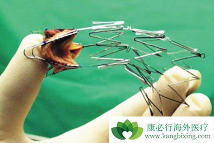 心脏支架手术过程图片