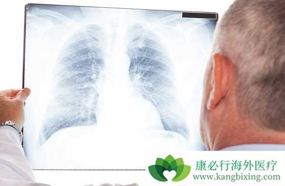 �ΰ���ת��