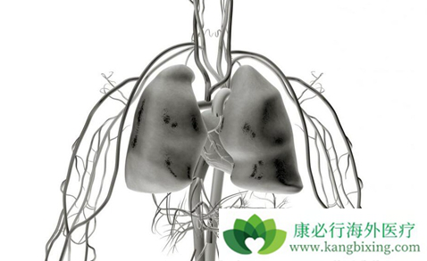 肺癌能治好吗 肺癌能治好吗