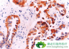 �ΰ��ٰ����������������ƺ�ת��Ϊ�ΰ��۰�����ô����