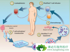 FDA��׼������CARTϸ�������Ʒ��۸�ʮ�ְ���