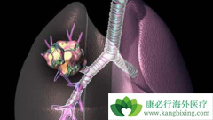 ���ڷΰ���������Ч�����ڷΰ������ֶ���ʲô��