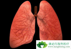 ��������(Xalkori)�����ܵķΰ����߿ɲ��ÿ�����������METͻ��