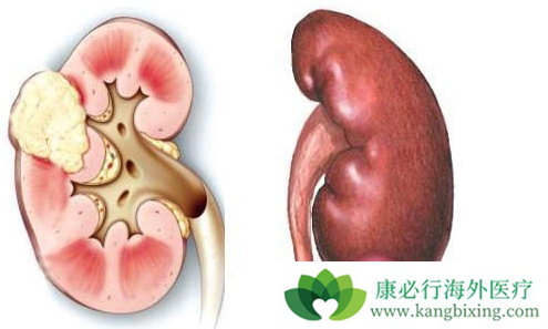 舒尼替尼 舒尼替尼