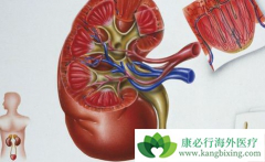 ��������(Sunitinib)�Ͱ�������������mRCC�������Ƶ���Ч�Ͱ�ȫ��