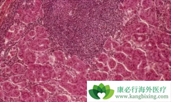 �ܰ����״�����ܰͰ�֢״����Ҫ���ܰͰ����Ʒ�����ʲô