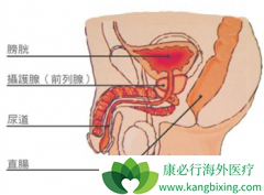 ���Է����ֲ���ʹ����������ǰ���ٰ�֢״