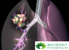  ʲô���ķ��۰������ʺ��������⣿ 