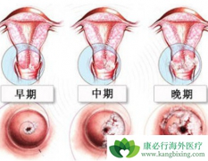 ���������⼸���仯�������ӹ���֢״