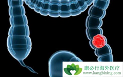 ת���Խ�ֱ�������߷��ð����(REGONIX)�������Щ������Ӧ