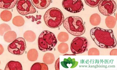 ��������/��������������ϵϸ����Ѫ�������ƾ��л�ʱ������