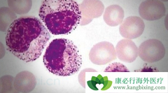 ���޻�(Rituximab)�յ�����SLL��MZL���ӳ�������Чʱ��