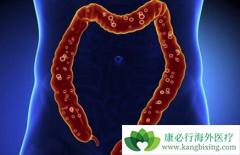 �󳦰�֢״����Щ����α��󳦰�