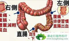 �������ֱ��ظ�ʹҪ�����Ǵ󳦰�֢״