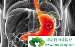 ����û��ʳ���Բ��·������Ű�֢״��һ��