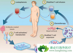 CAR-Tϸ���Ʒ���������ϸ�������ͷ��ۺ���