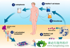 Ibrutinib�����CAR-T����ЧӦ��һ���²���