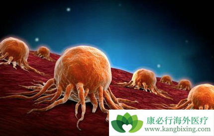 癌症晚期能活多久 癌症晚期能活多久