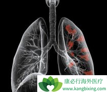 �ĸ�С���ɽ������Ԥ���ΰ�������