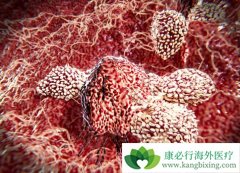 ��Ȭ��(keytruda)������ε�����ʲô�������ͣ��keytruda��