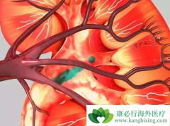 ��Щ��������(Sunitinib)������ӦԤʾ�źõ���Ч